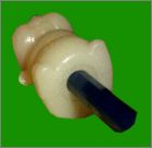 Vue de l'embout crayon